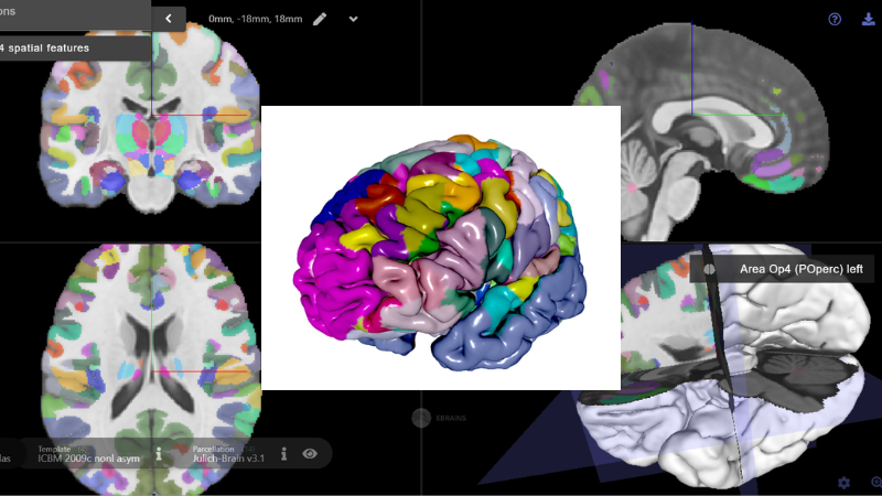 Avances del Proyecto Human Brain Project: Un Nuevo Paradigma en la Investigación del Cerebro Humano